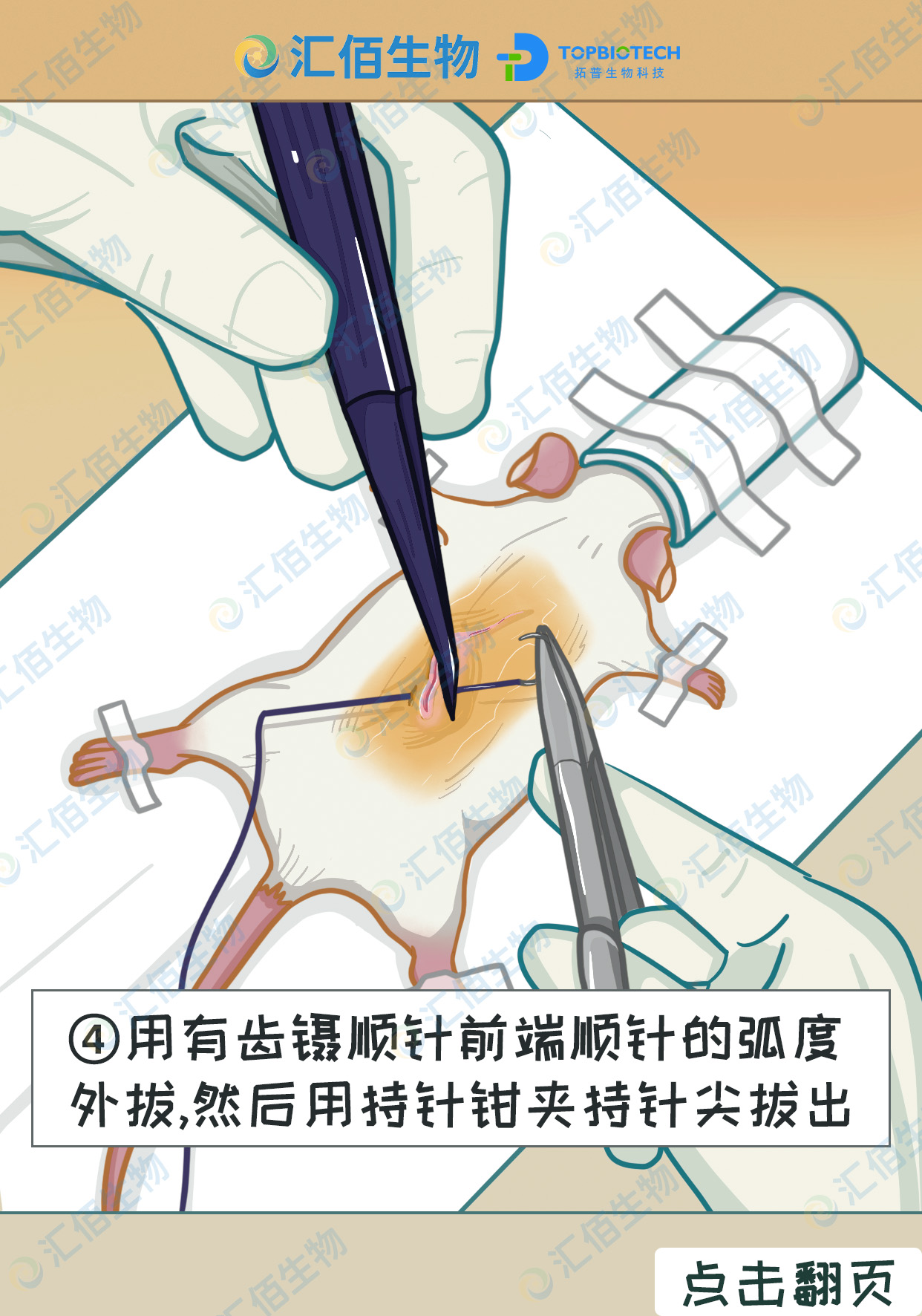 04步骤四,用有齿镊顺针前端顺针的弧度 外拔,然后用持针钳夹持针尖拔出.jpg
